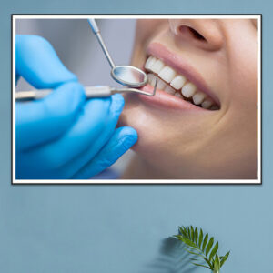 tranh nha khoa nghệ thuật khám răng mã số TL005